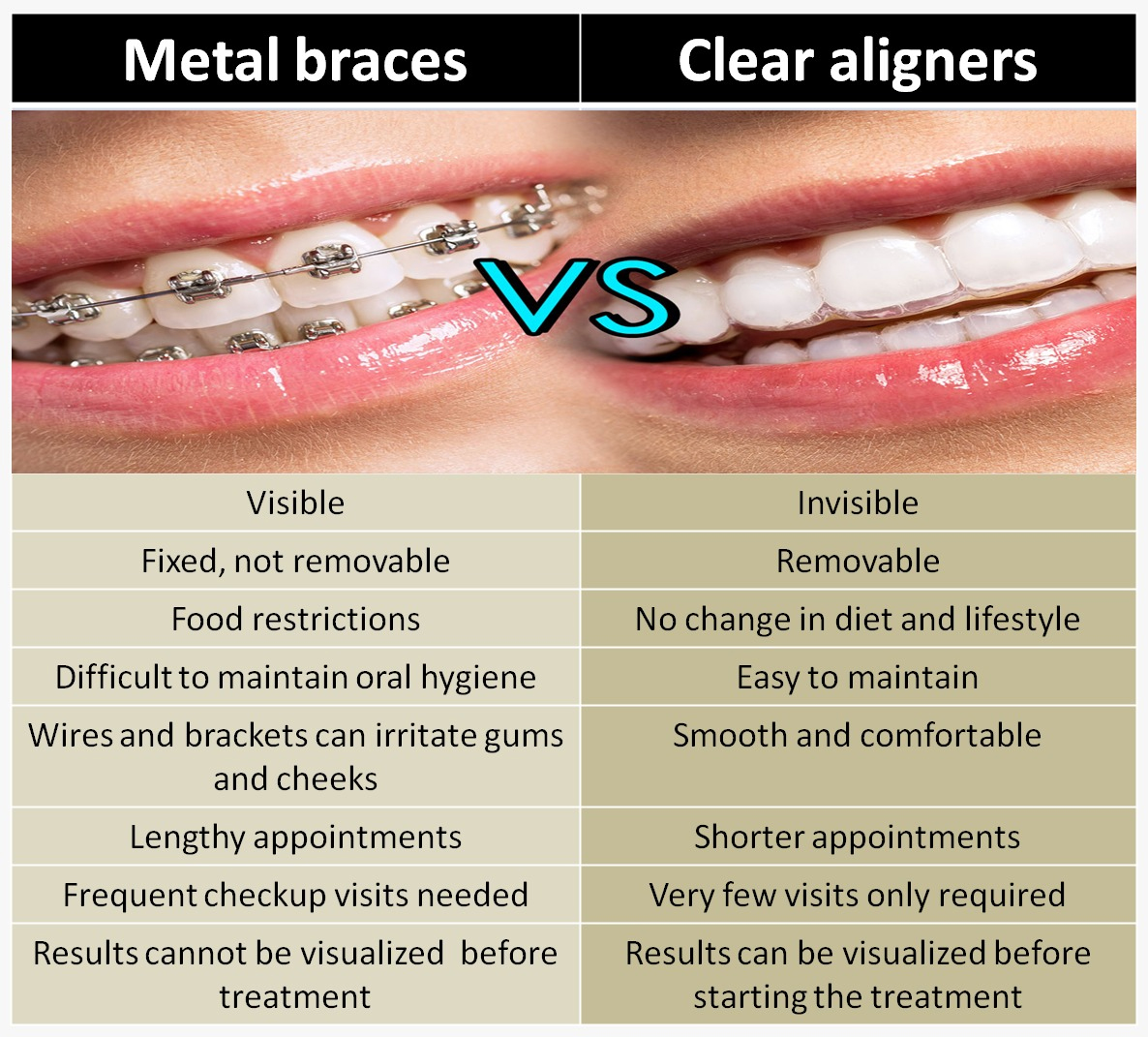 Clear Aligners Treatment